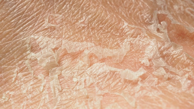 Pourquoi votre peau a besoin d'une crème corps hydratante dédiée