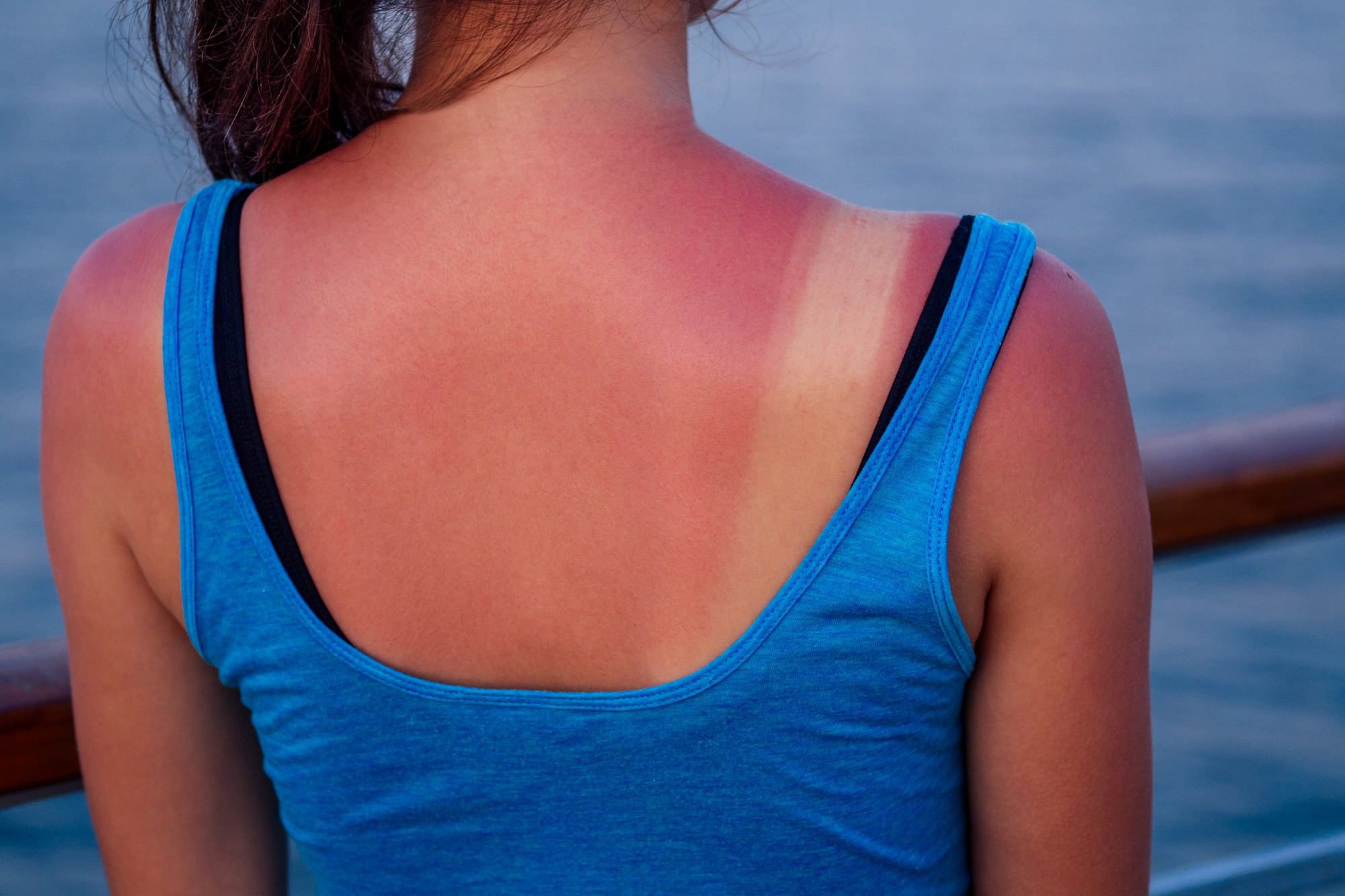Quelles sont les causes des taches brunes sur le visage ?