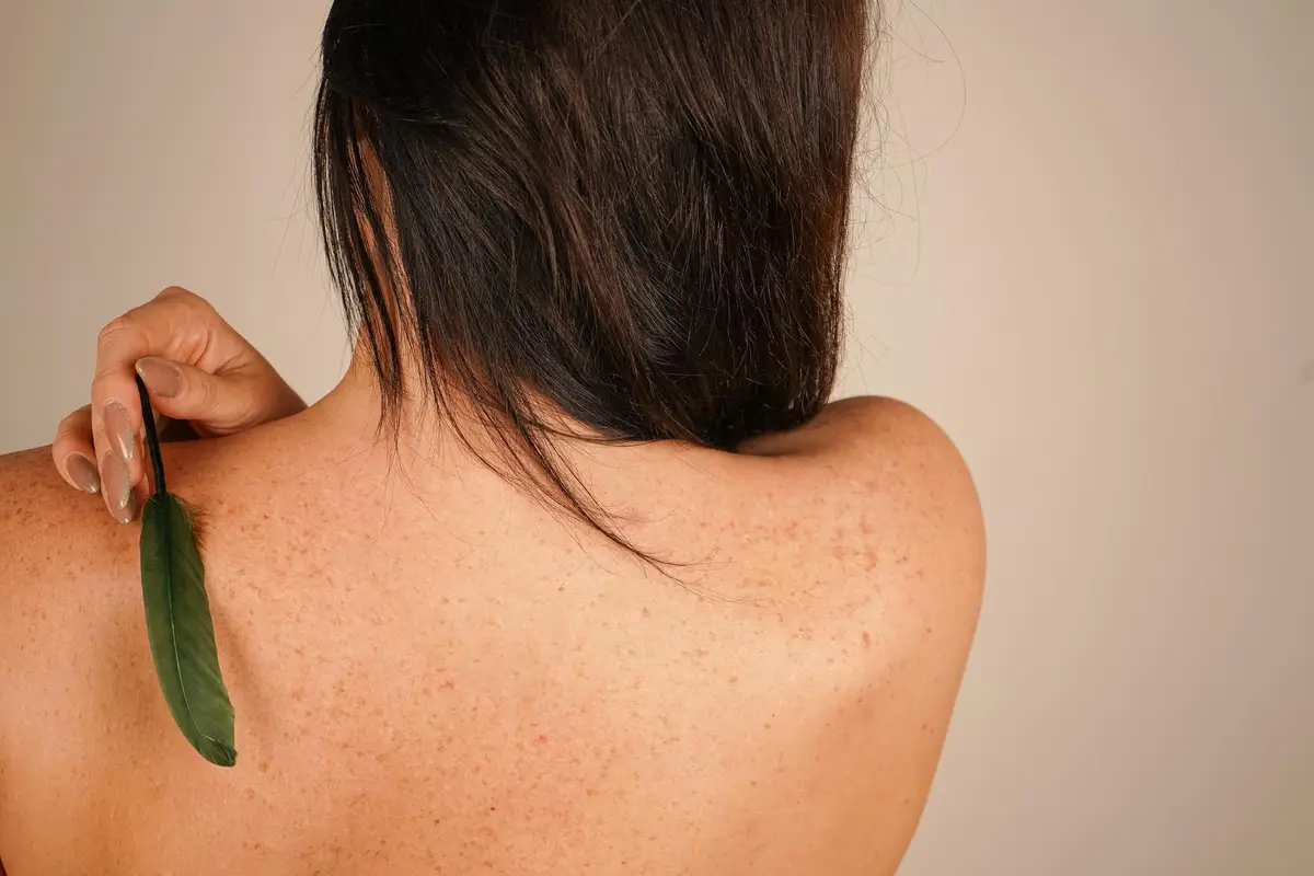 dos acné points noirs profonds extraction naturelle