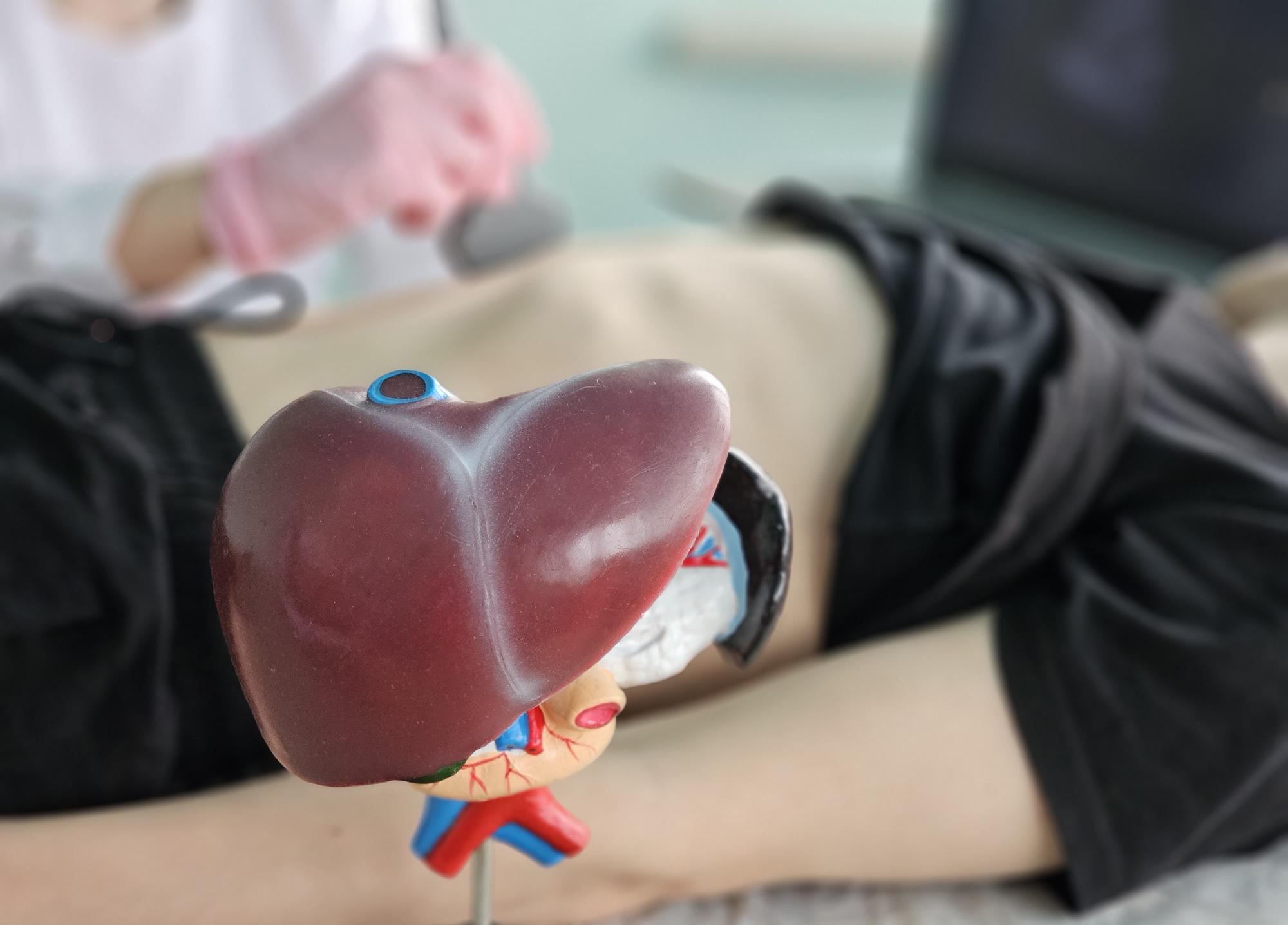 Que révèle un taux élevé de gamma glutamyl transférase ?
