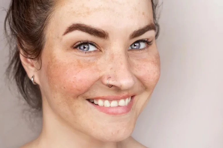 skin spots face