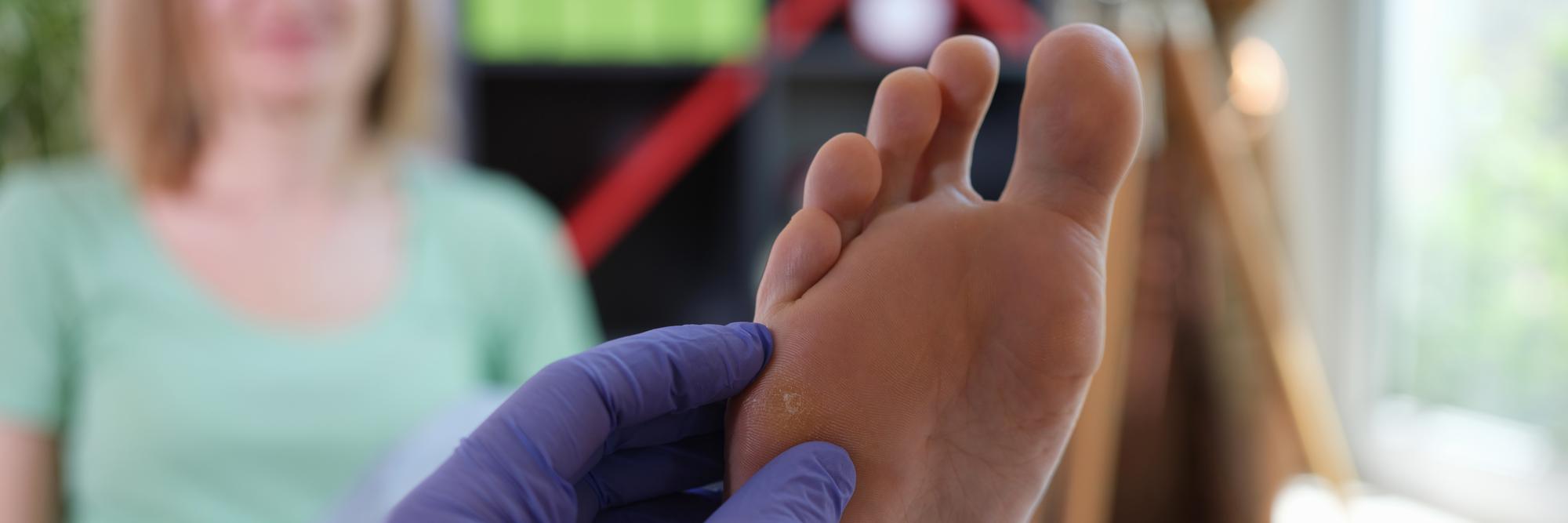 Comment savoir si ses ongles de pieds sont en bonne santé ?