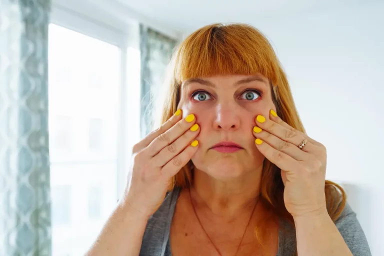 puffy eyes woman