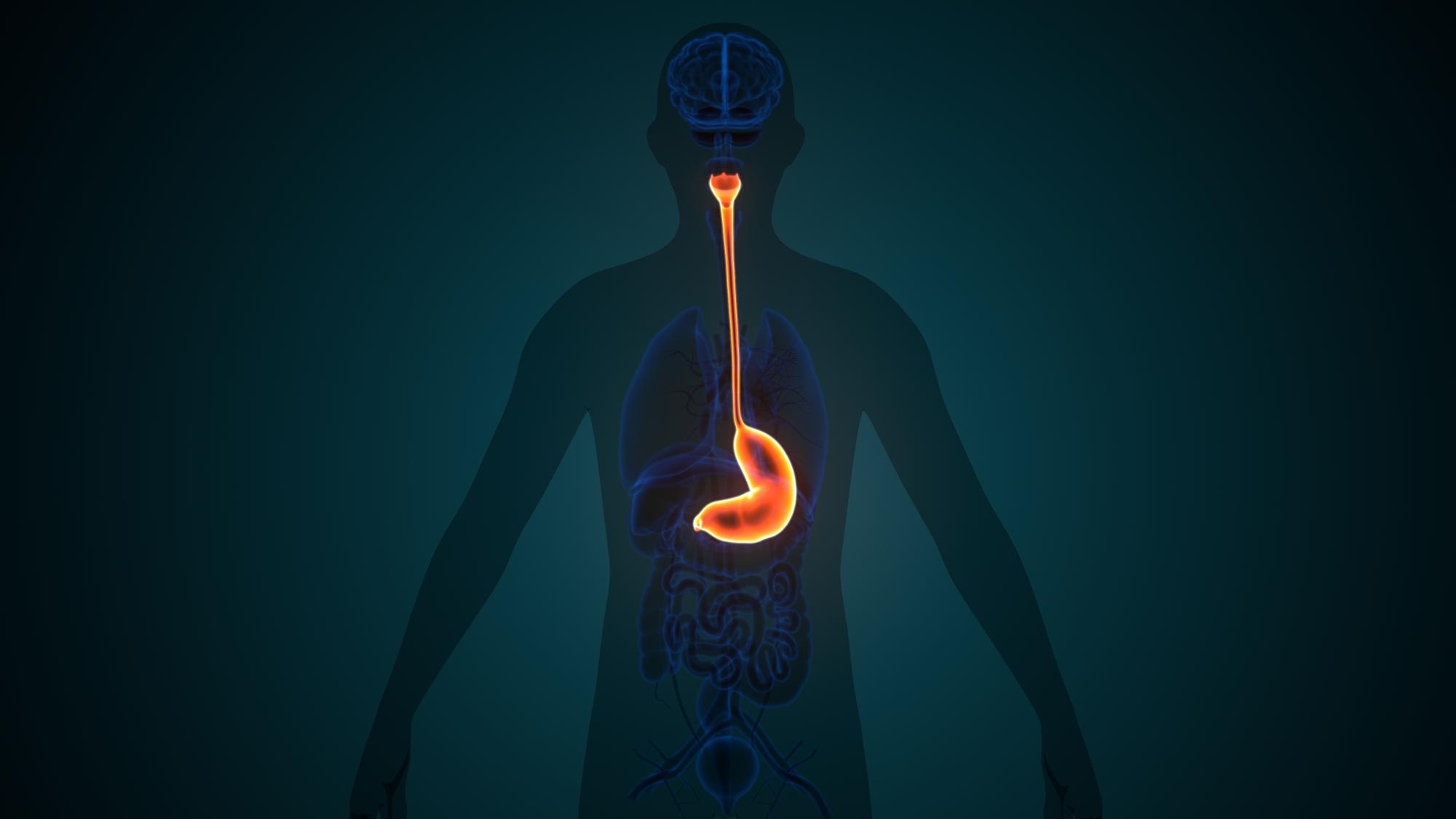 Qu’est-ce qu’un reflux gastrique et pourquoi ça brûle autant ?