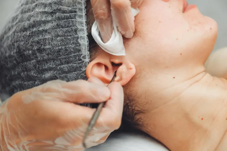 ear blackhead skin