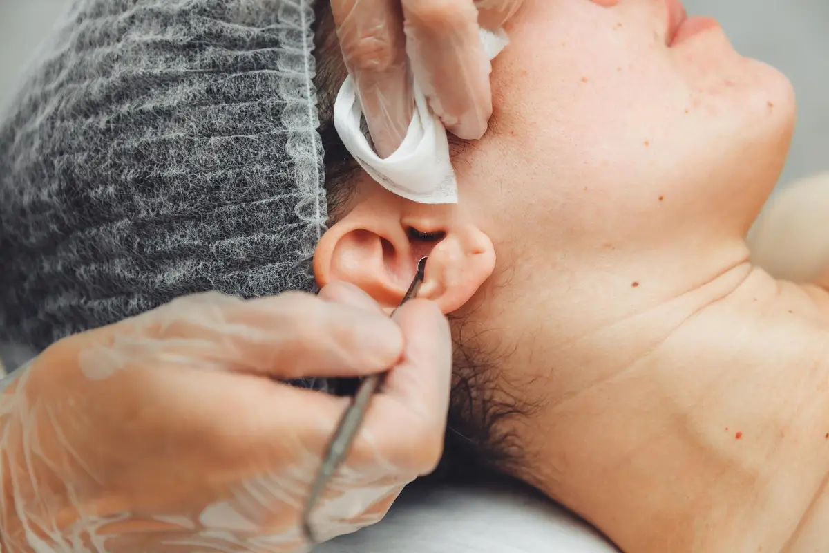 ear blackhead skin