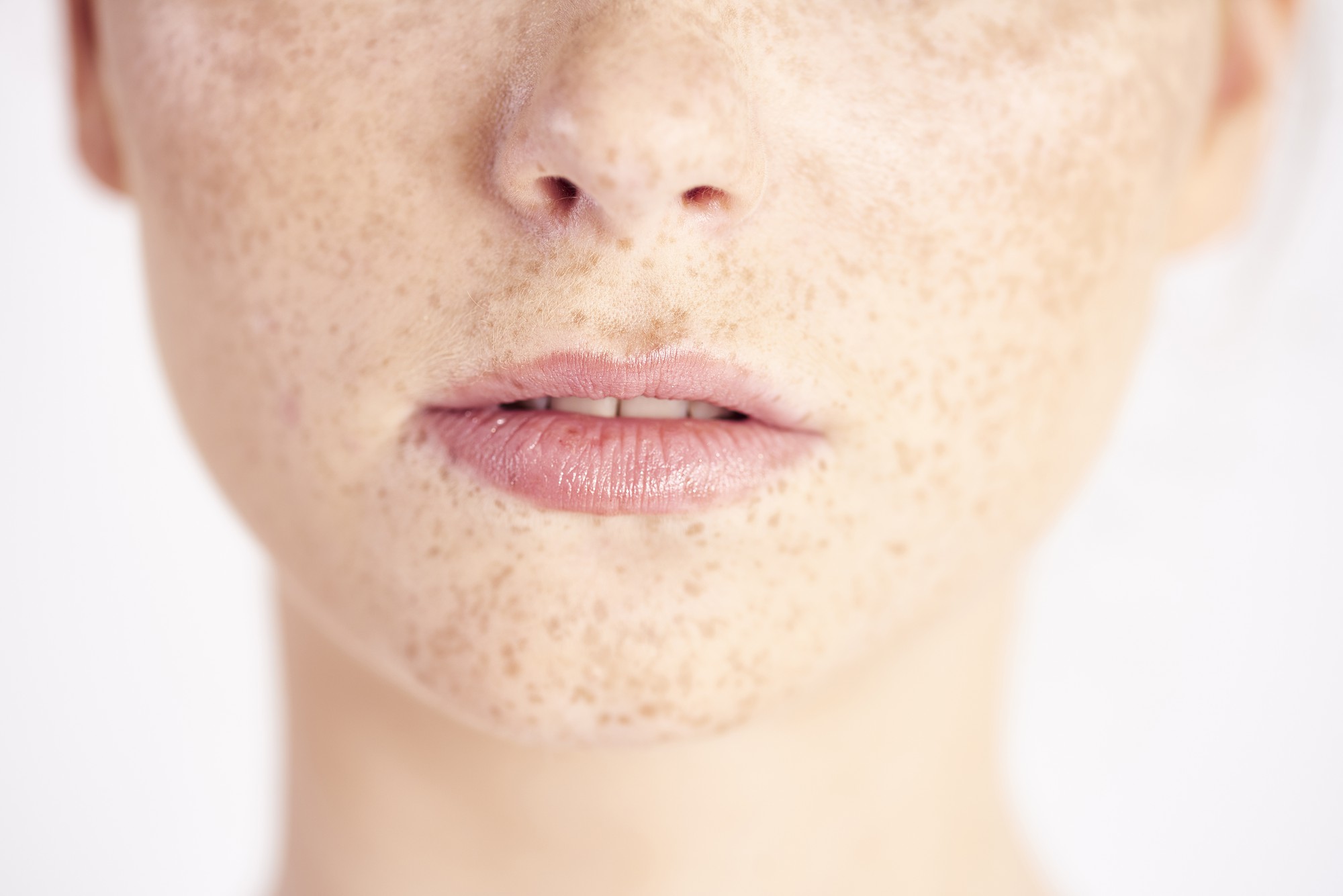 À quoi ressemblent ces petits boutons sur le visage ?