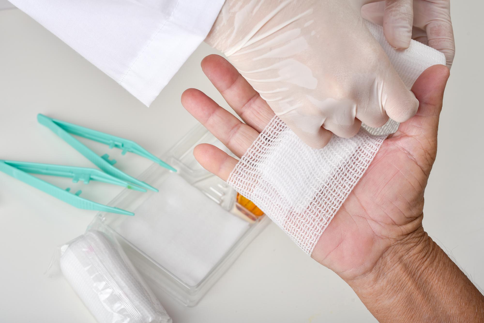 L’argile est-elle adaptée à une plaie ou à une cicatrice ?